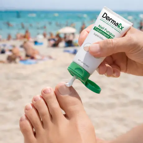 Dermafix nail gel tube being applied to a toenail